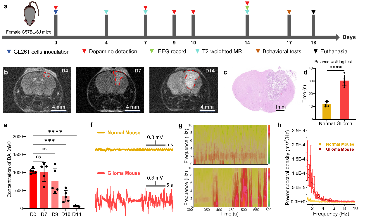 Significant Breakthrough in Dynamic Monitoring of Neurochemical Signals